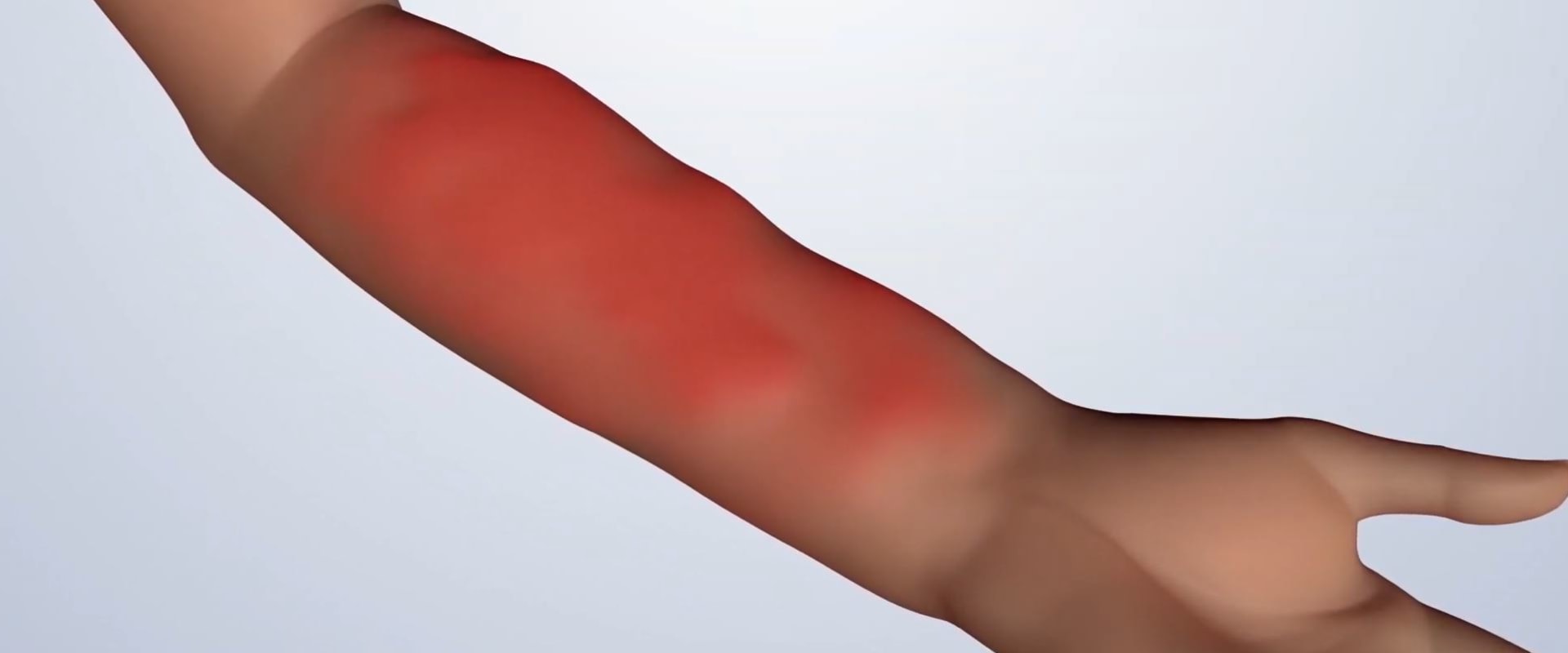 Recognizing Warning Signs: Understanding the Potential Risks of Soft Wave Therapy