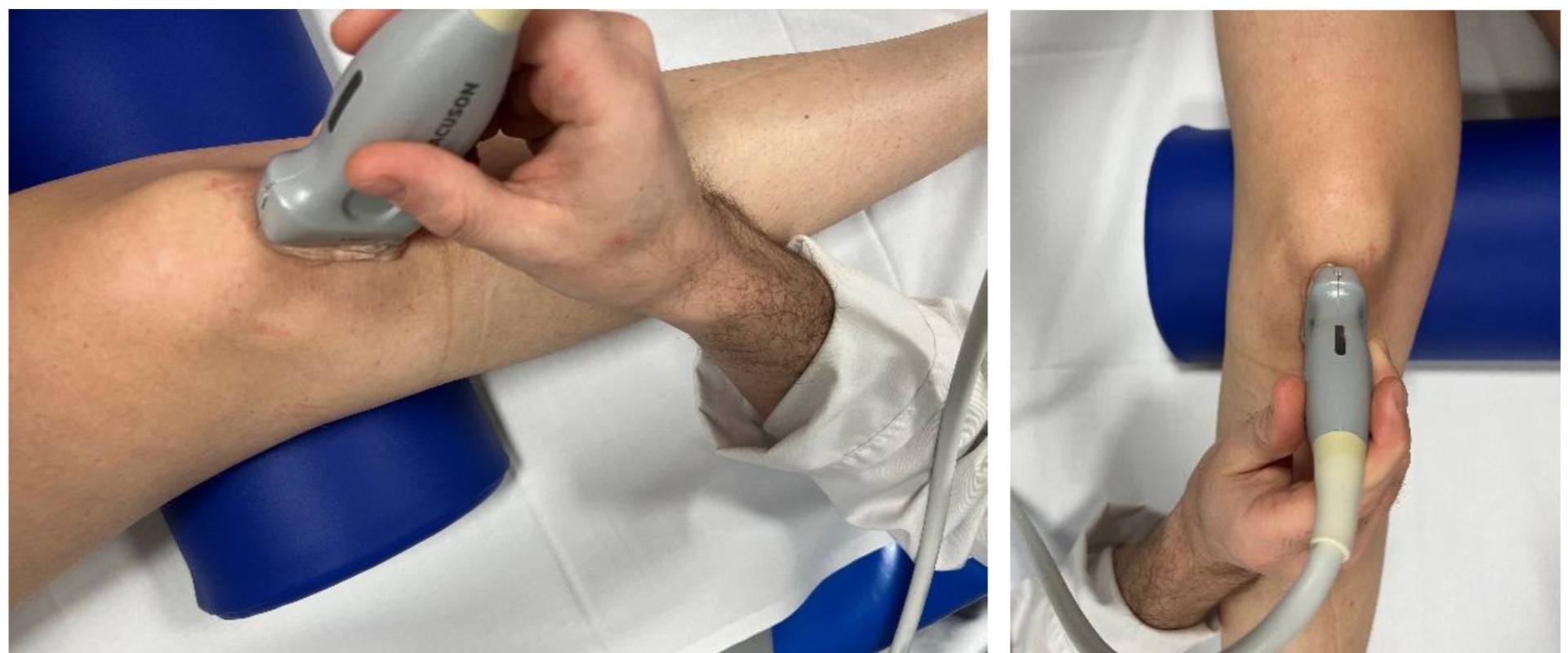 Soft Wave Therapy for Sports Teams: A Comprehensive Guide