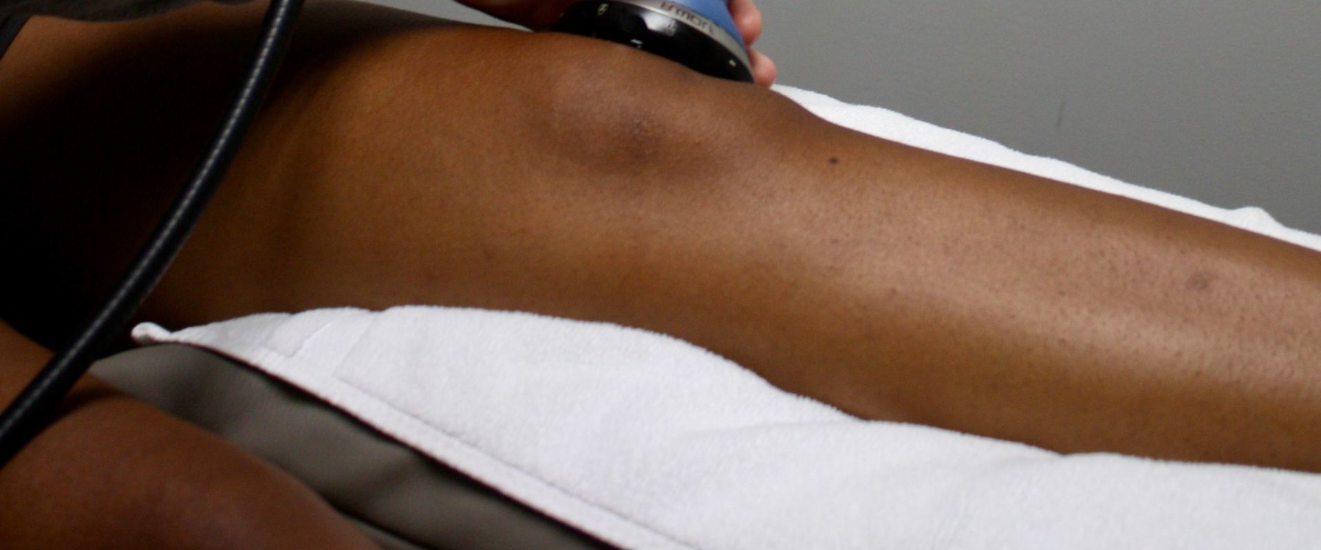 A Comprehensive Look at Tendinopathies and the Benefits of Soft Wave Therapy