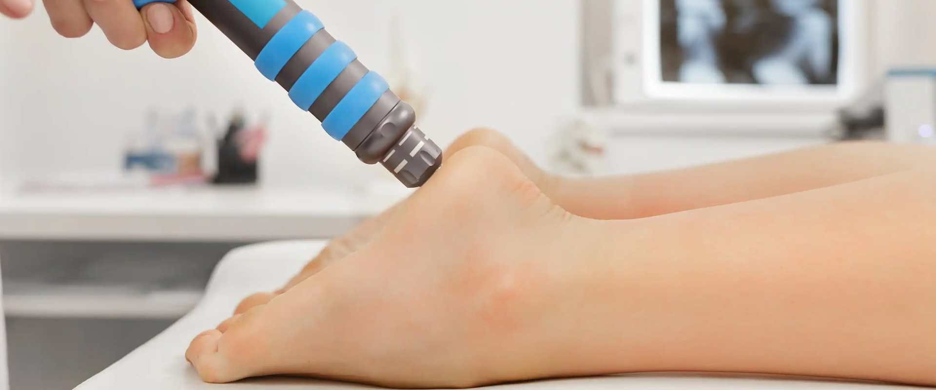 Soft Wave Therapy for Plantar Fasciitis: What You Need to Know