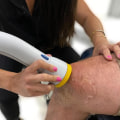 The Benefits of Soft Wave Therapy for Wound Healing