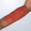 Recognizing Warning Signs: Understanding the Potential Risks of Soft Wave Therapy