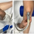 Soft Wave Therapy for Sports Teams: A Comprehensive Guide