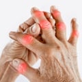 Understanding Rheumatoid Arthritis and Soft Wave Therapy