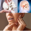 Understanding Temporomandibular Joint (TMJ) Disorder