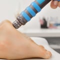 Soft Wave Therapy for Plantar Fasciitis: What You Need to Know
