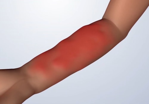 Recognizing Warning Signs: Understanding the Potential Risks of Soft Wave Therapy
