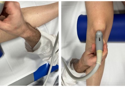 Soft Wave Therapy for Sports Teams: A Comprehensive Guide