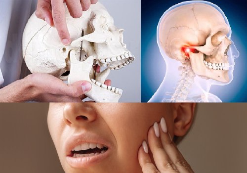 Understanding Temporomandibular Joint (TMJ) Disorder