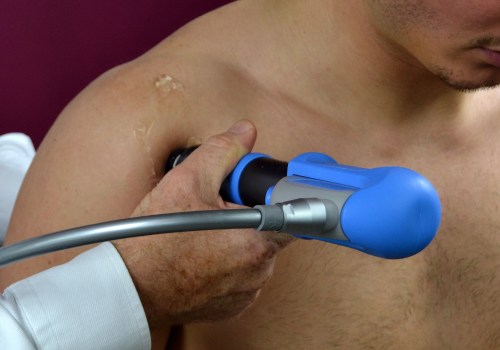 What is shock wave therapy for tendonitis?